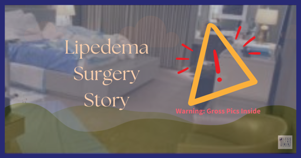 Lipedema Surgery Story